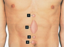 Sites of umbilical hernias